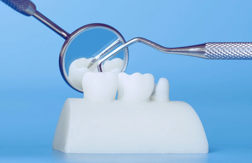 Restaurações Estéticas