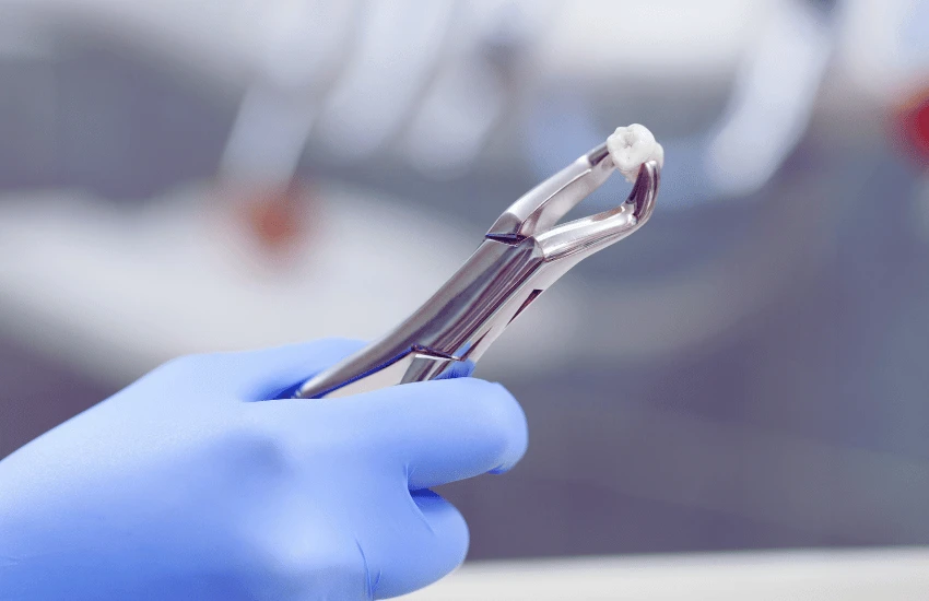 Extrações e Cirurgias Orais